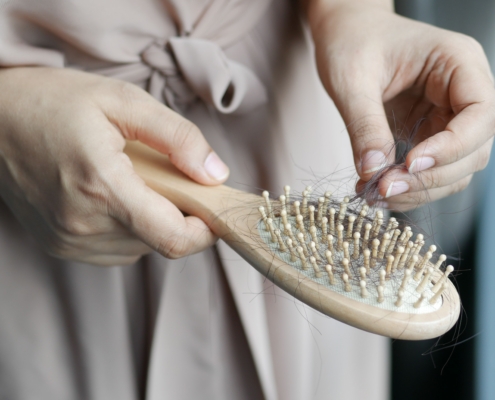 Hormones, Gut Health, and Stress What’s Really Behind Hair Loss in Women and Men